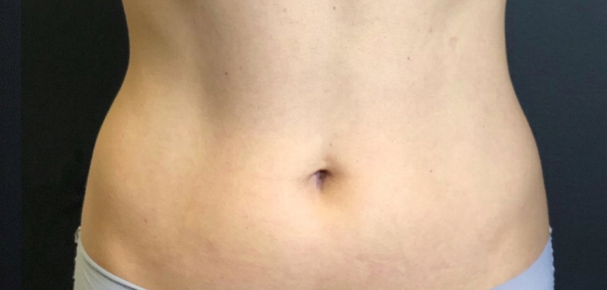 Trusculpt After