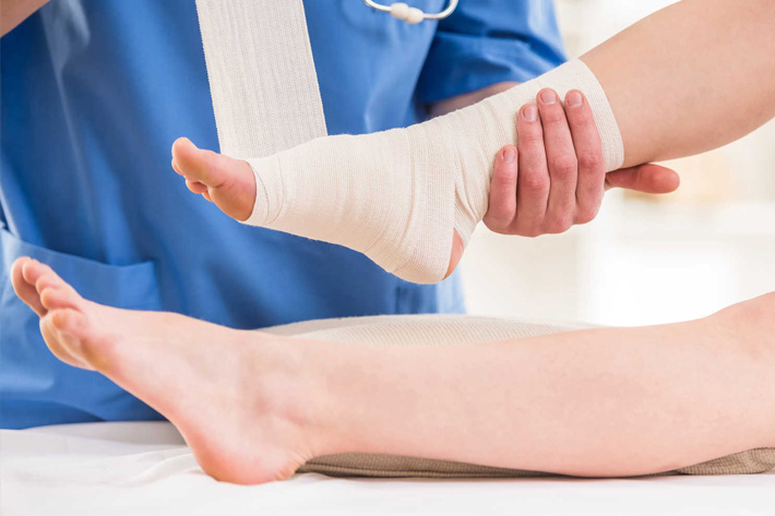Treating Leg Ulcers