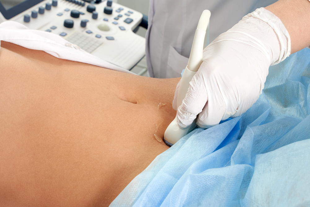 Pelvic varicose vein symptoms